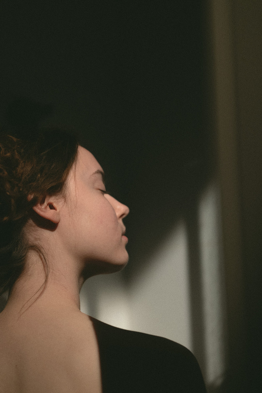 What are Venus Rings, why do they occur and how to deal with them? CURE